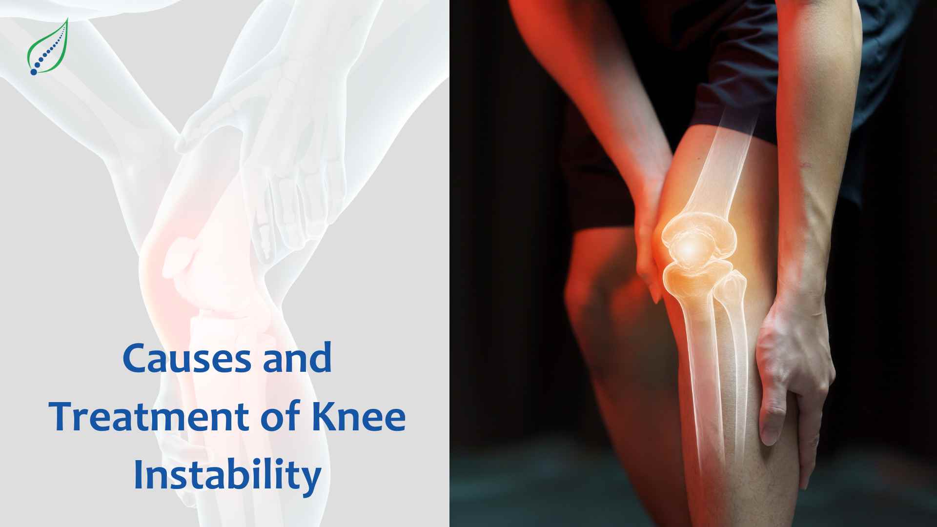 Causes and Treatment of Knee Instability